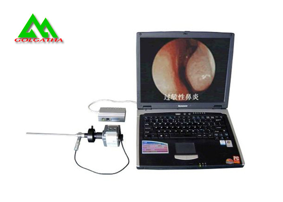 중국 내시경 검사 공동 수술 내시경/방수 사진기 영상 내시경 검사 협력 업체
