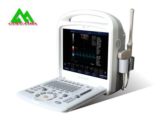 중국 병원 의학 초음파 장비 휴대용 색깔 도풀러 노트북 디자인 협력 업체